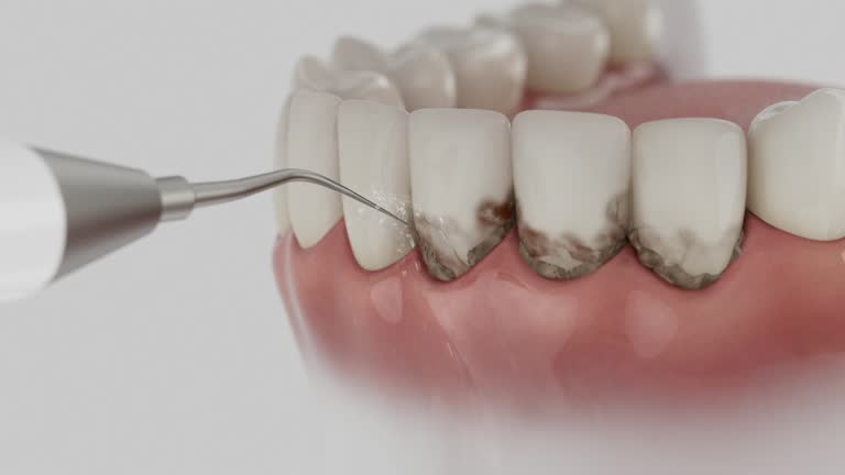 Reliable Dental contractor in Bel-Ridge, MO by Dentist Open Now